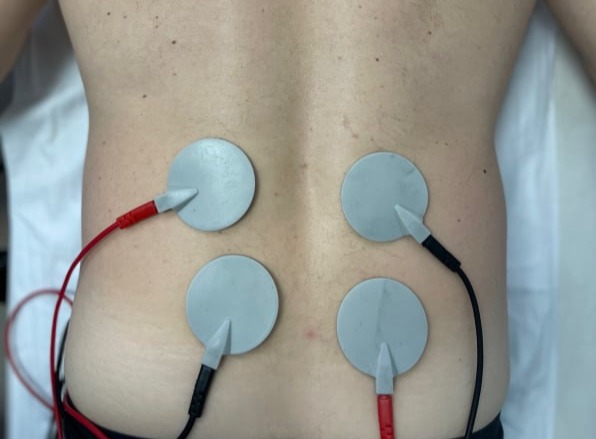 ΗΛΕΚΤΡΟΘΕΡΑΠΕΙΑ