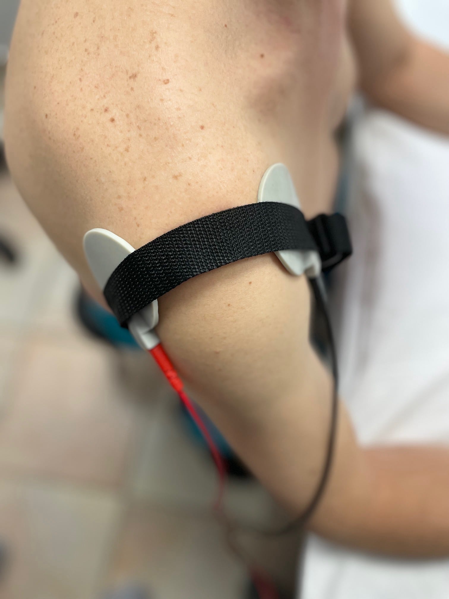 Ηλεκτροθεραπεία